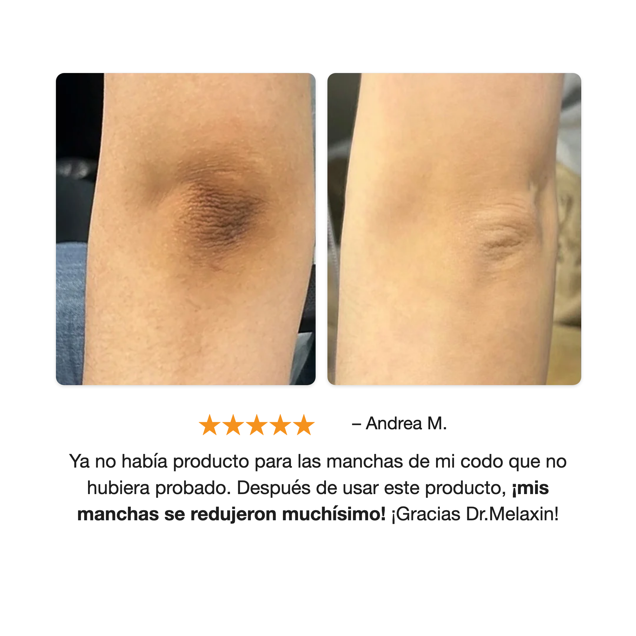 Antes y después reportado por una usuaria de Dr. Melaxin